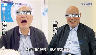 朱爷爷75岁上半口种植
